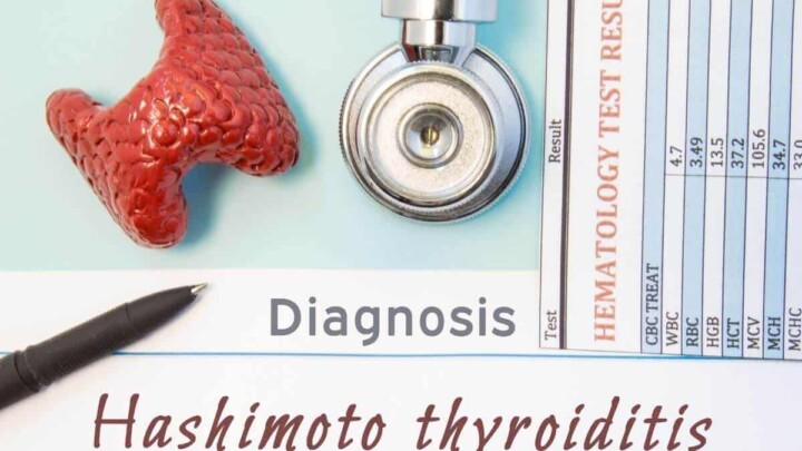 3 Powerful Thyroid Nutrients in Diet for Healthy Function